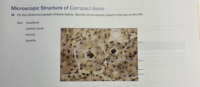 Identify the tissue depicted in the photomicrograph.