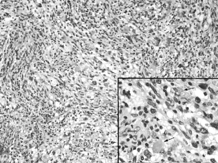 Microscopic appearance muscle tissue neuromuscular describe briefly junction skeletal photomicrograph identify structures following solved transcribed text show